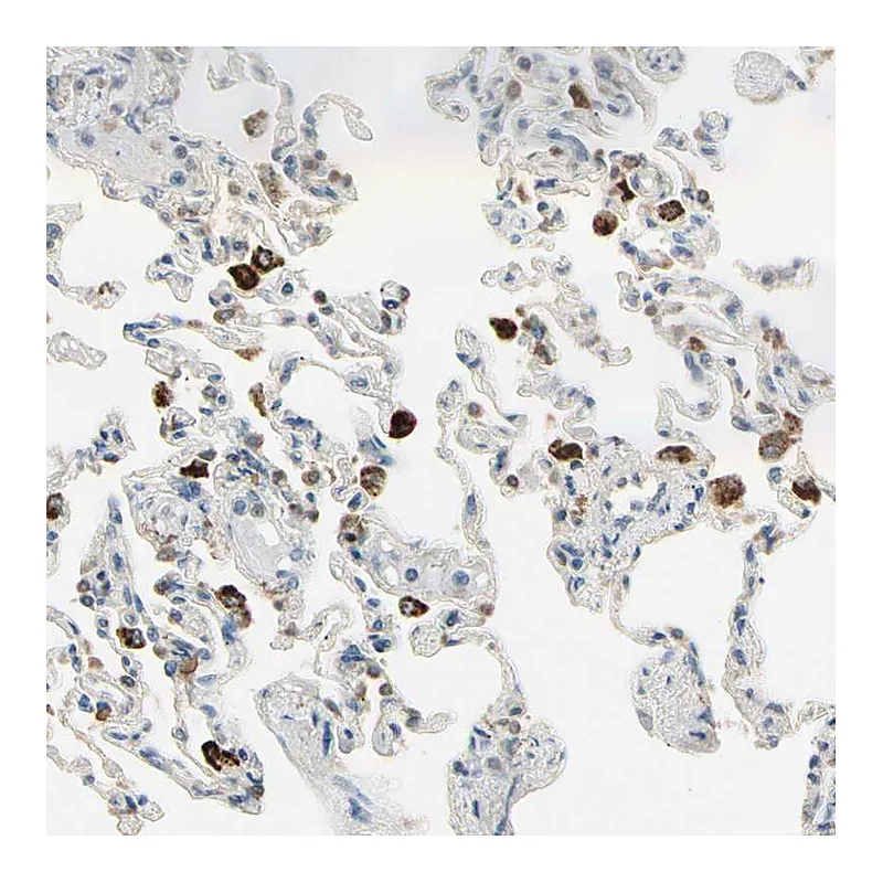 Atlas Antibodies Anti-PLXNA1 Antibody
