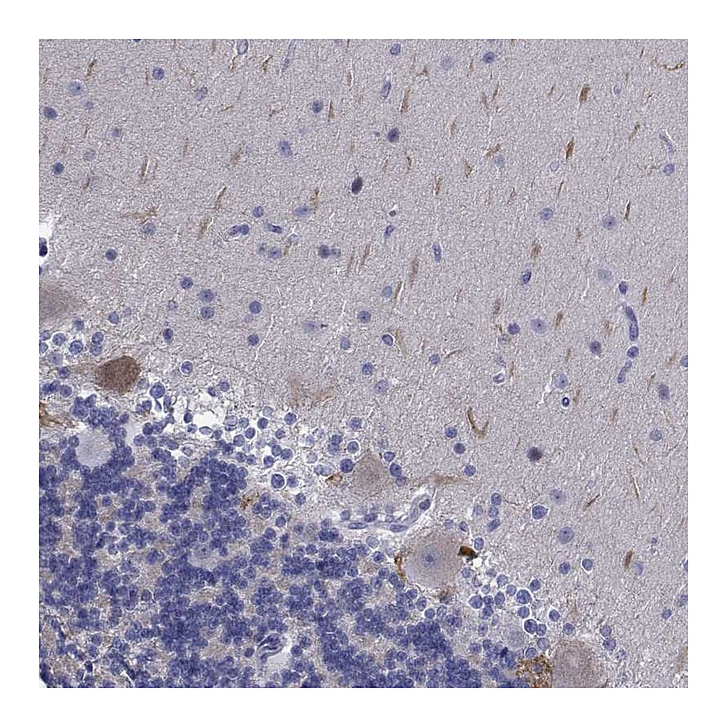 Atlas Antibodies Anti-PLXNA4 Antibody