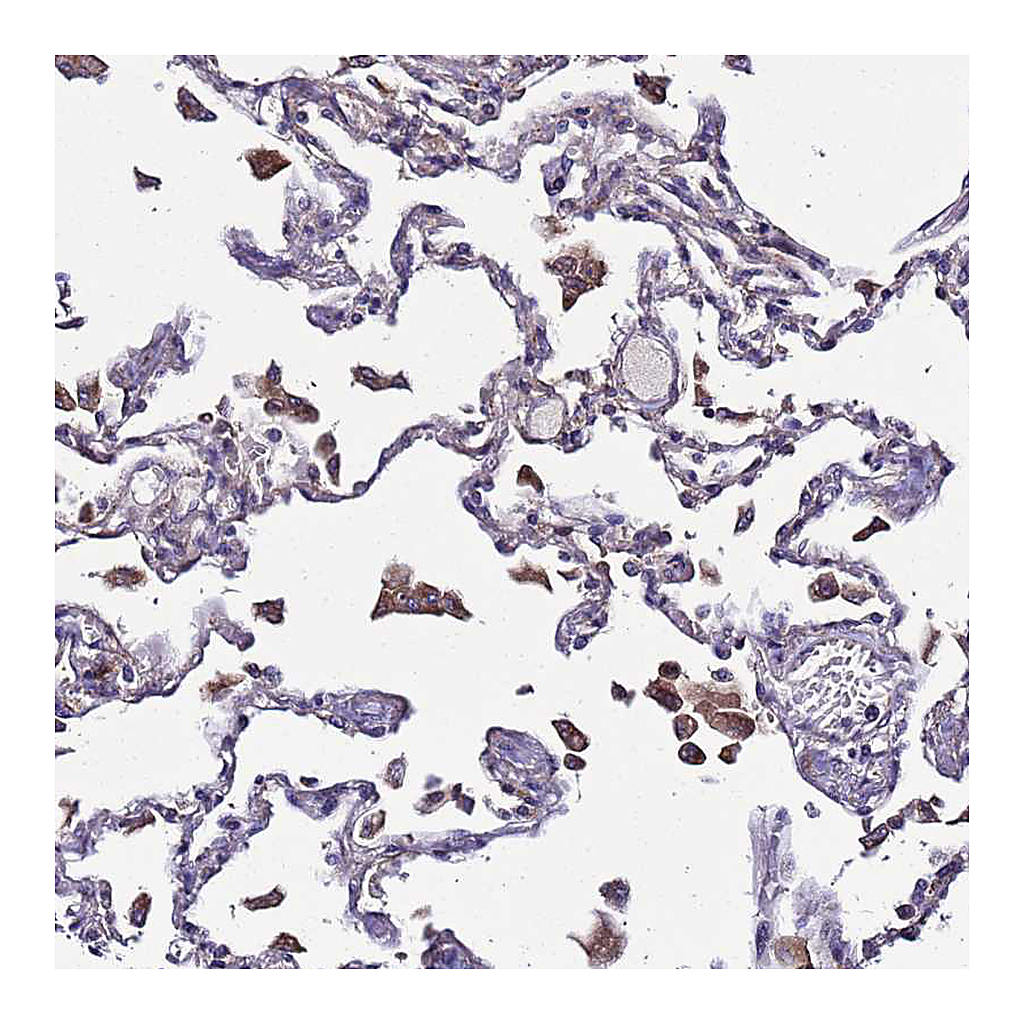 Atlas Antibodies Anti-PLXDC2 Antibody