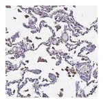 Atlas Antibodies Anti-PLXDC2 Antibody
