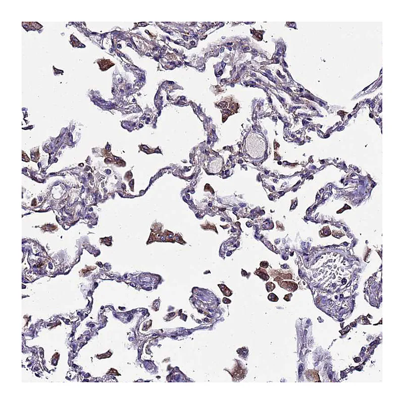 Atlas Antibodies Anti-PLXDC2 Antibody
