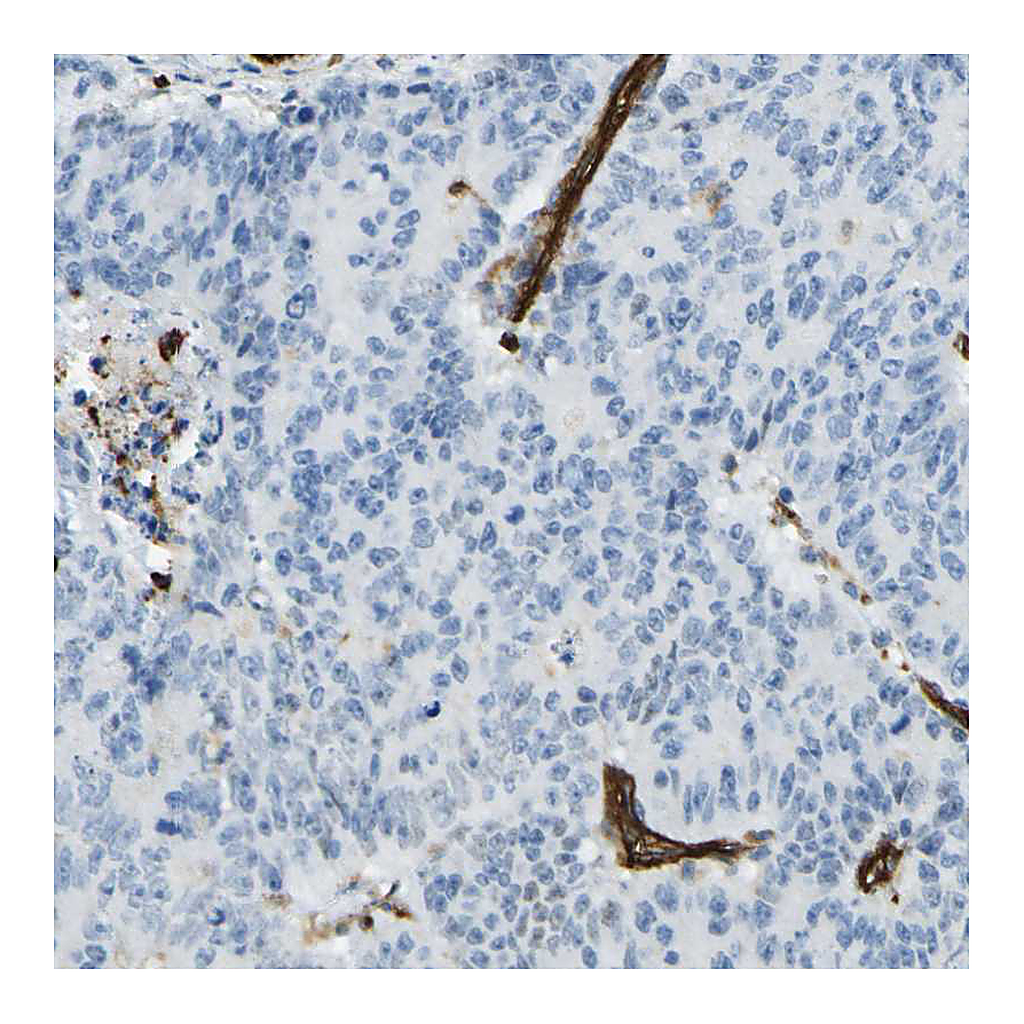 Atlas Antibodies Anti-PLXDC1 Antibody