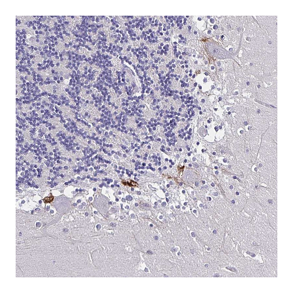 Atlas Antibodies Anti-PLXNA4 Antibody