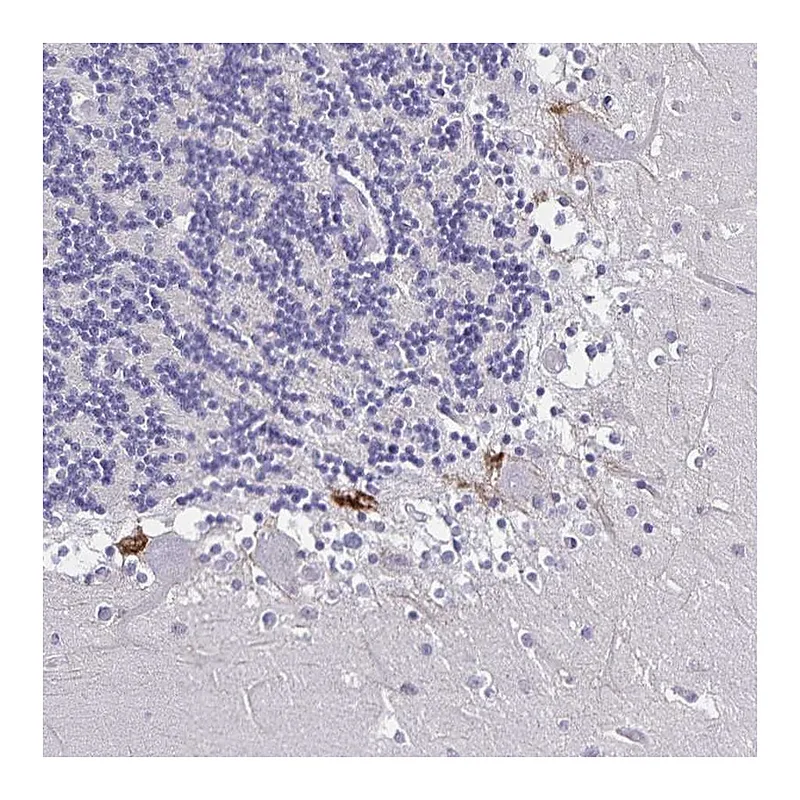 Atlas Antibodies Anti-PLXNA4 Antibody