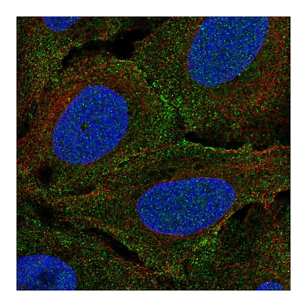 Atlas Antibodies Anti-PLXNA4 Antibody