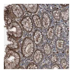 Atlas Antibodies Anti-PLXNB2 Antibody