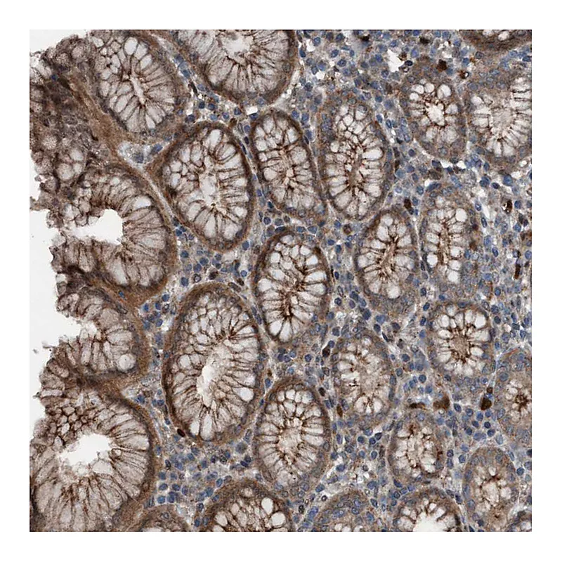 Atlas Antibodies Anti-PLXNB2 Antibody