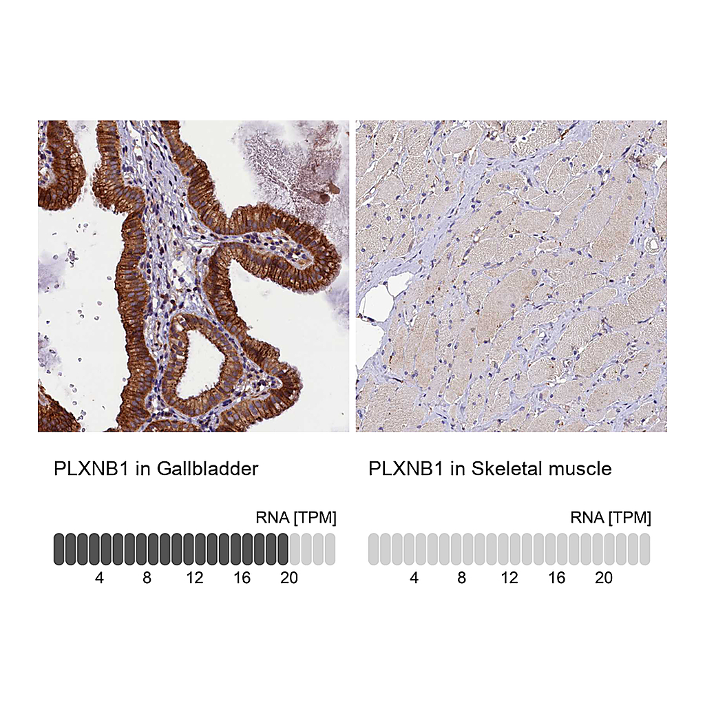 Atlas Antibodies Anti-PLXNB1 Antibody
