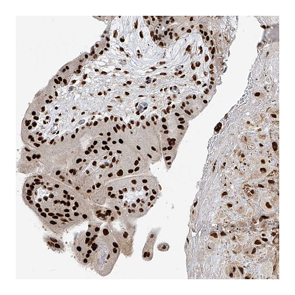 Atlas Antibodies Anti-PM20D2 Antibody