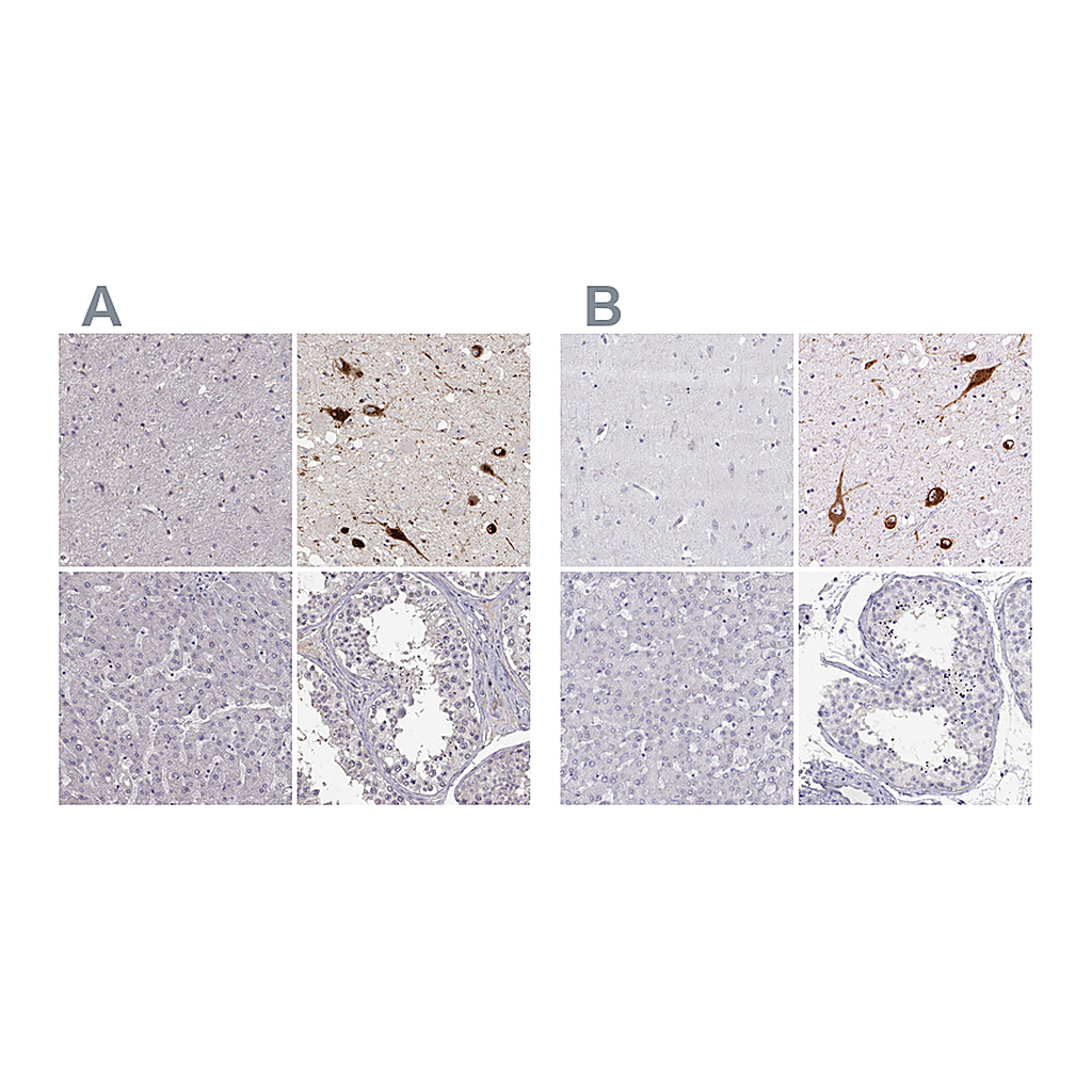 Atlas Antibodies Anti-PMCH Antibody
