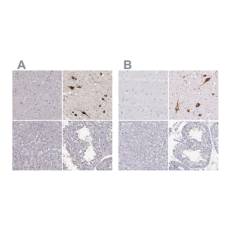 Atlas Antibodies Anti-PMCH Antibody