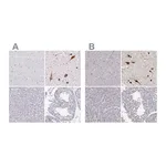 Atlas Antibodies Anti-PMCH Antibody
