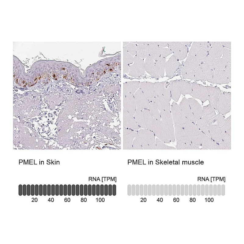 Atlas Antibodies Anti-PMEL Antibody