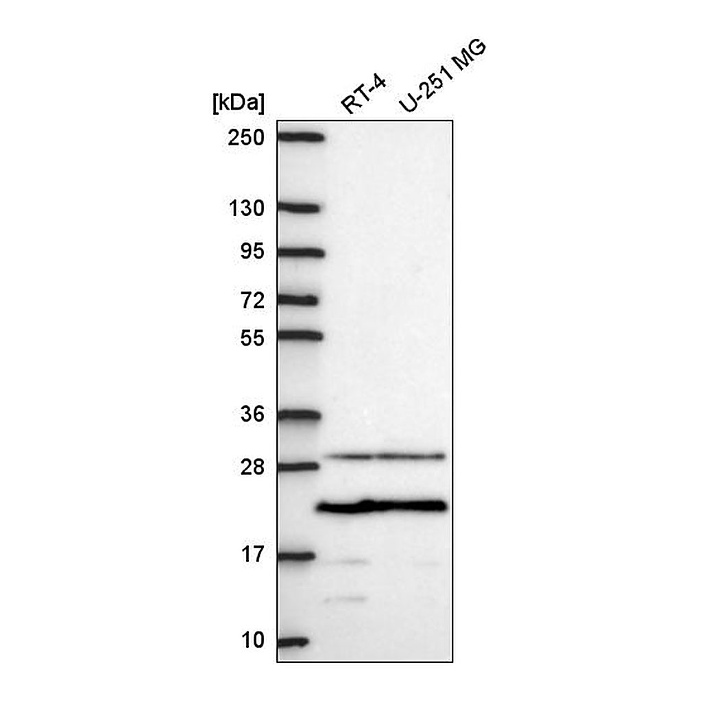 Atlas Antibodies Anti-PMEPA1 Antibody