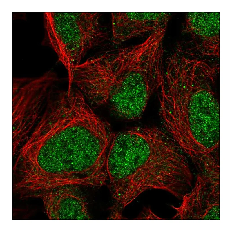 Atlas Antibodies Anti-PMF1 Antibody