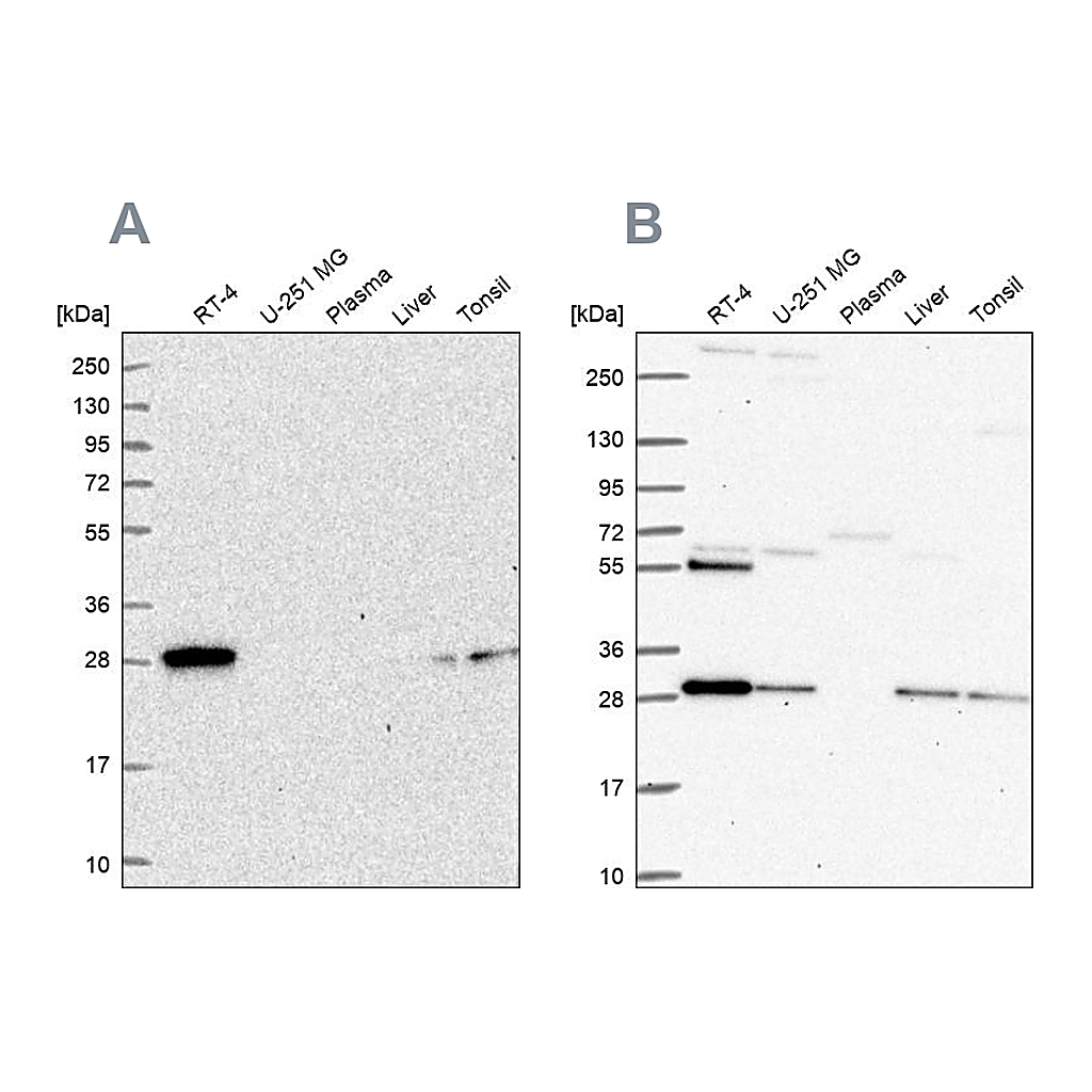 Atlas Antibodies Anti-PMM2 Antibody