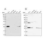 Atlas Antibodies Anti-PMM2 Antibody