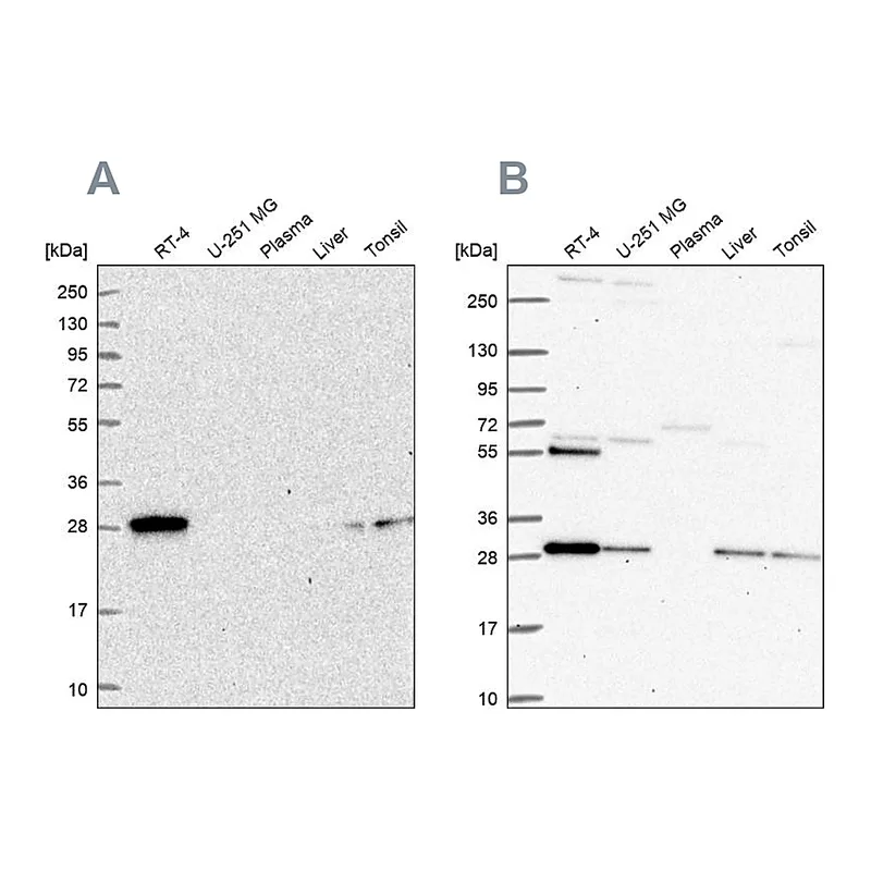Atlas Antibodies Anti-PMM2 Antibody