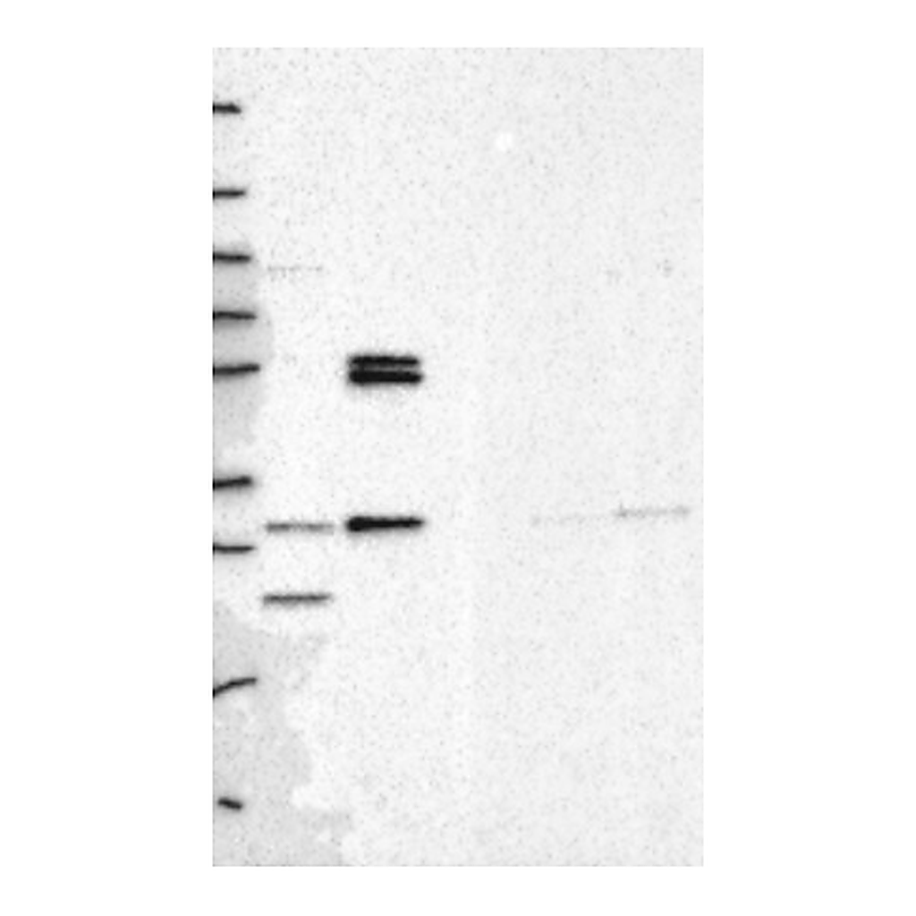 Atlas Antibodies Anti-PMM1 Antibody