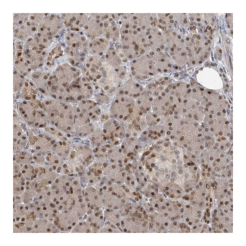Atlas Antibodies Anti-PMM1 Antibody