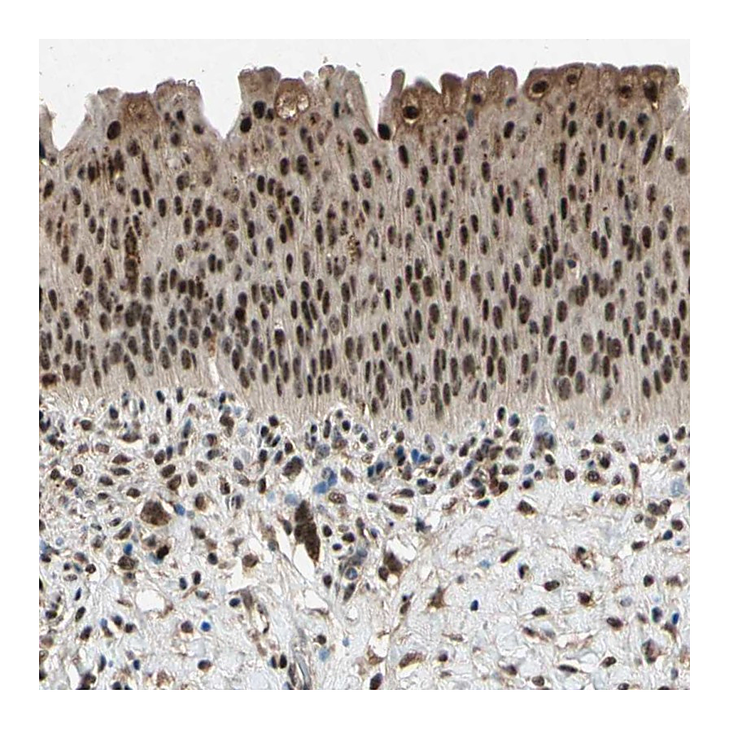 Atlas Antibodies Anti-PML Antibody