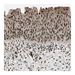 Atlas Antibodies Anti-PML Antibody