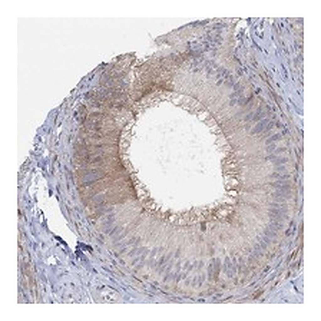 Atlas Antibodies Anti-PMFBP1 Antibody
