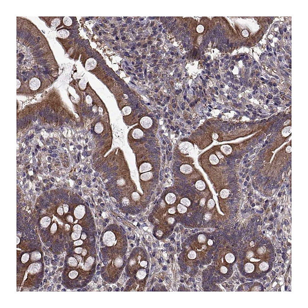 Atlas Antibodies Anti-PMM2 Antibody