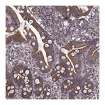 Atlas Antibodies Anti-PMM2 Antibody