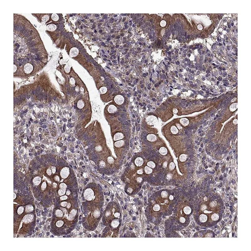 Atlas Antibodies Anti-PMM2 Antibody