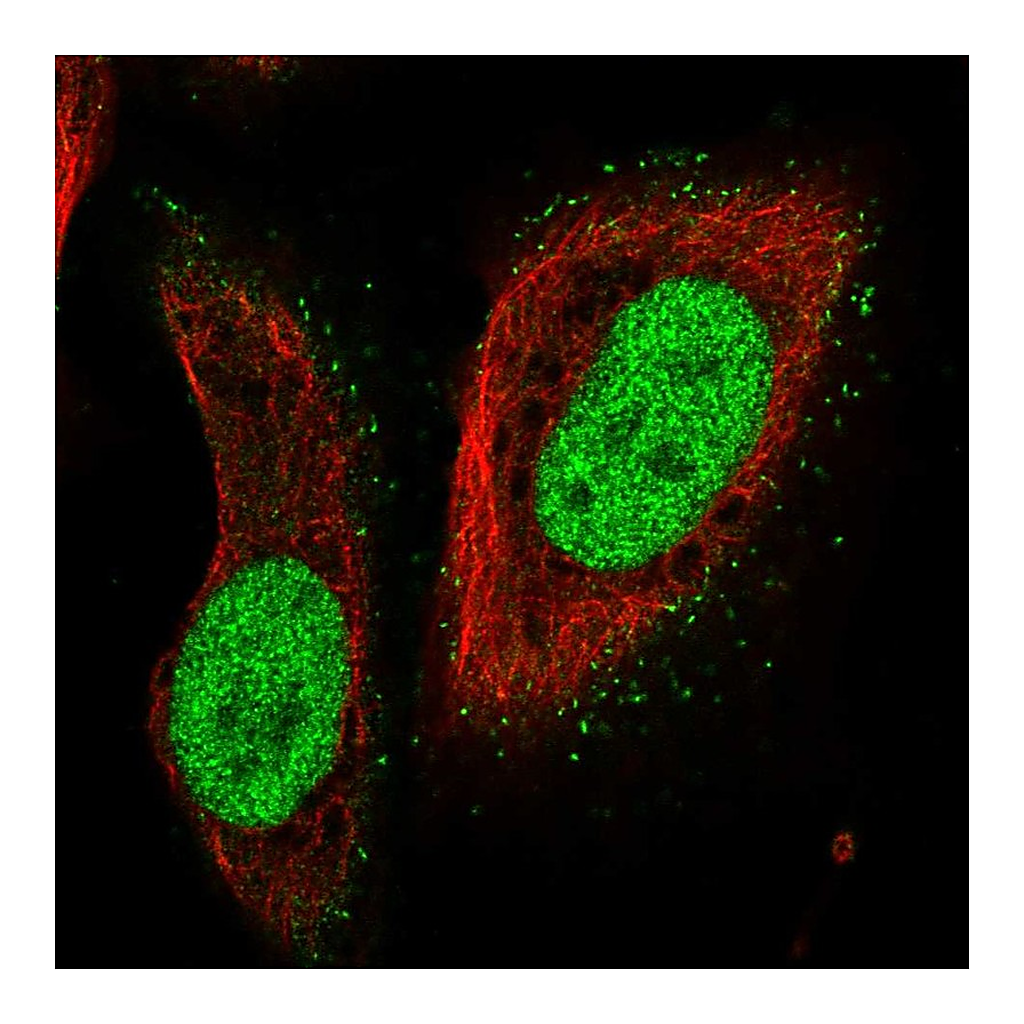 Atlas Antibodies Anti-PMS2 Antibody