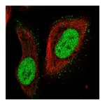 Atlas Antibodies Anti-PMS2 Antibody