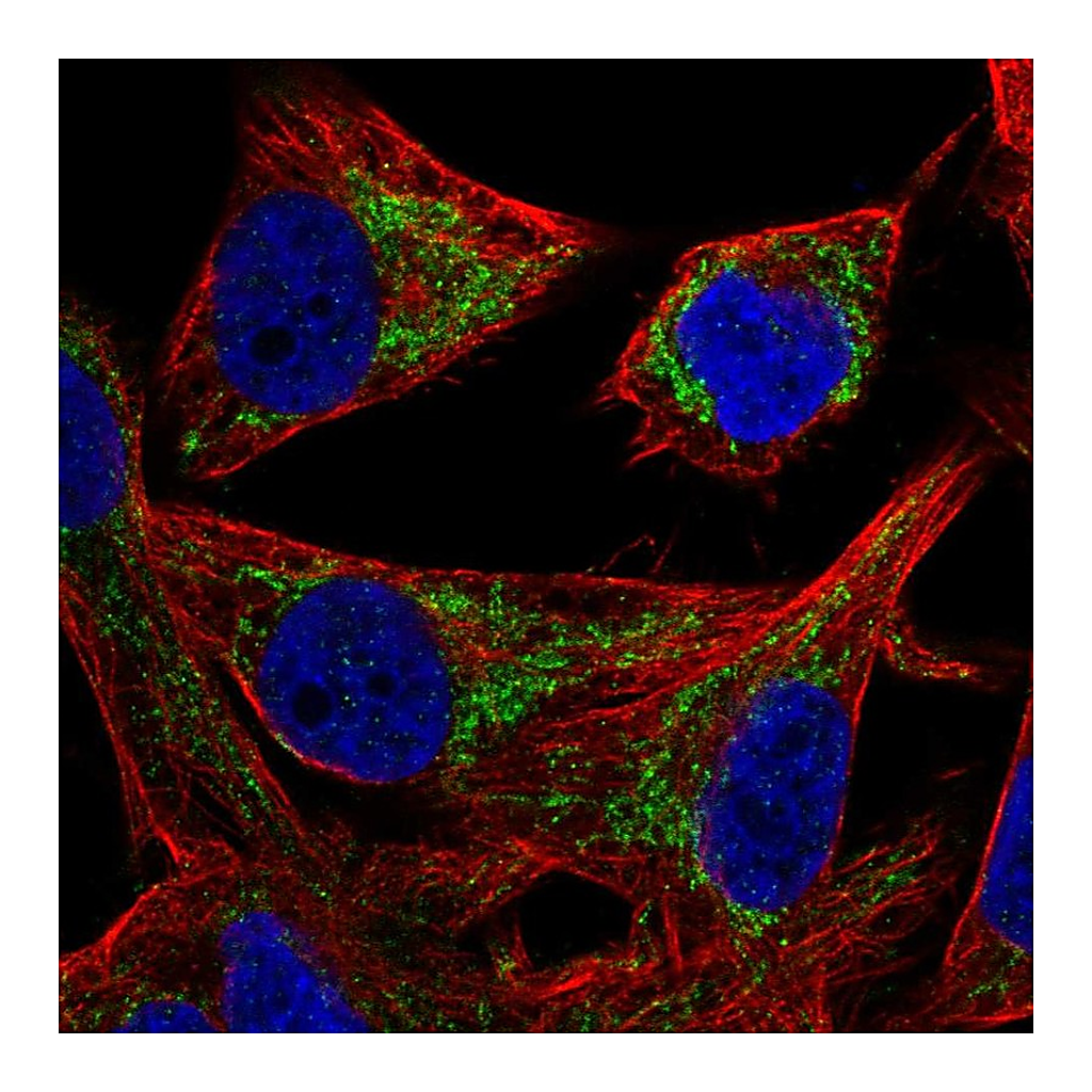 Atlas Antibodies Anti-PMPCB Antibody