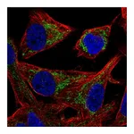 Atlas Antibodies Anti-PMPCB Antibody