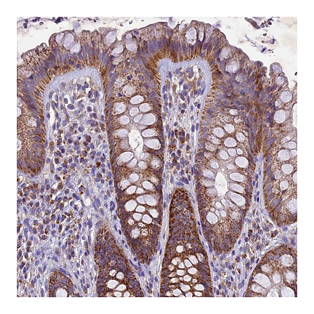 Atlas Antibodies Anti-PMPCB Antibody
