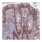 Atlas Antibodies Anti-PMPCB Antibody