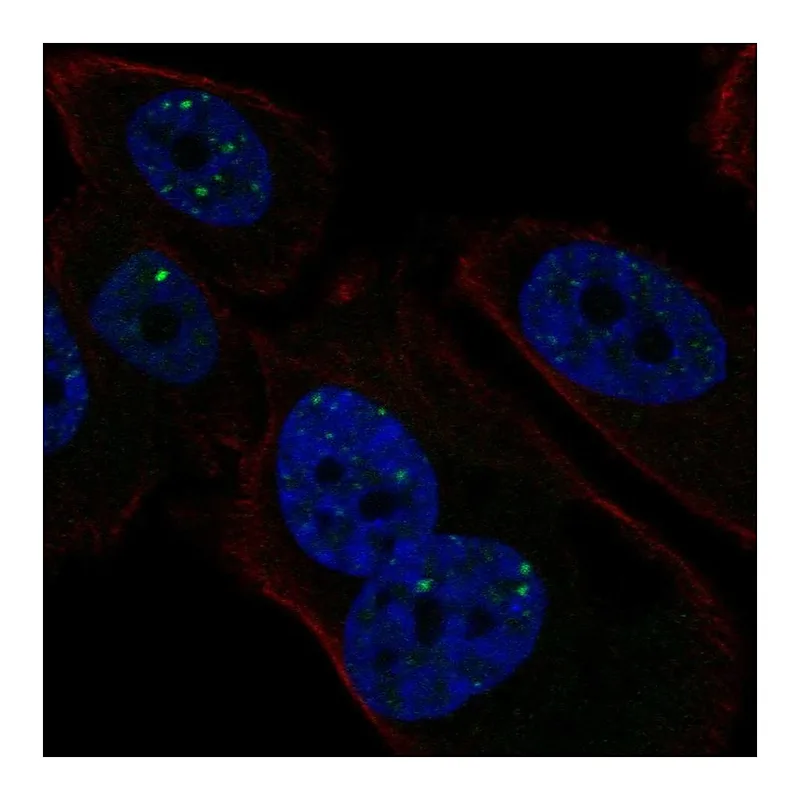 Atlas Antibodies Anti-PMS1 Antibody