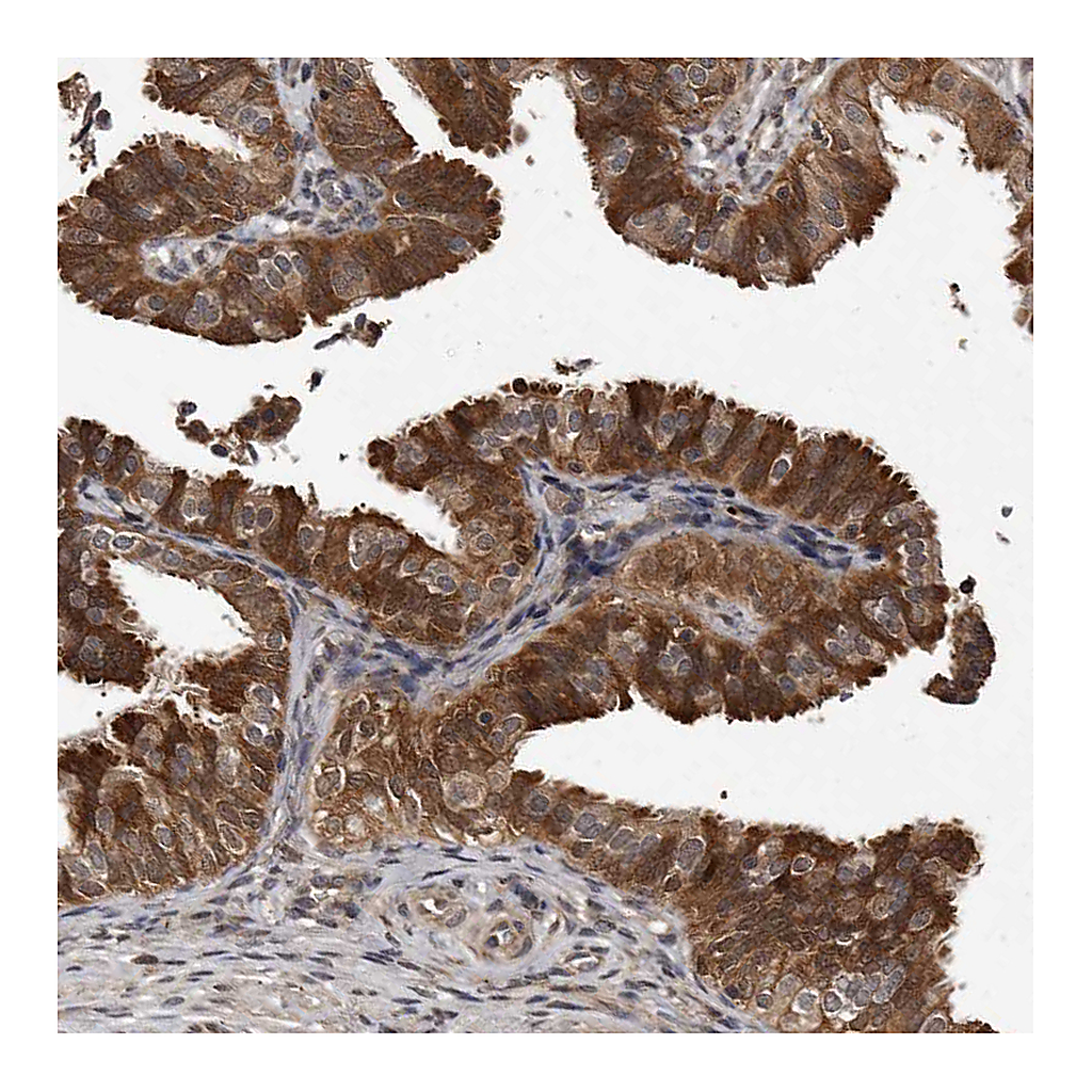 Atlas Antibodies Anti-PMVK Antibody