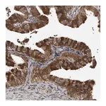 Atlas Antibodies Anti-PMVK Antibody