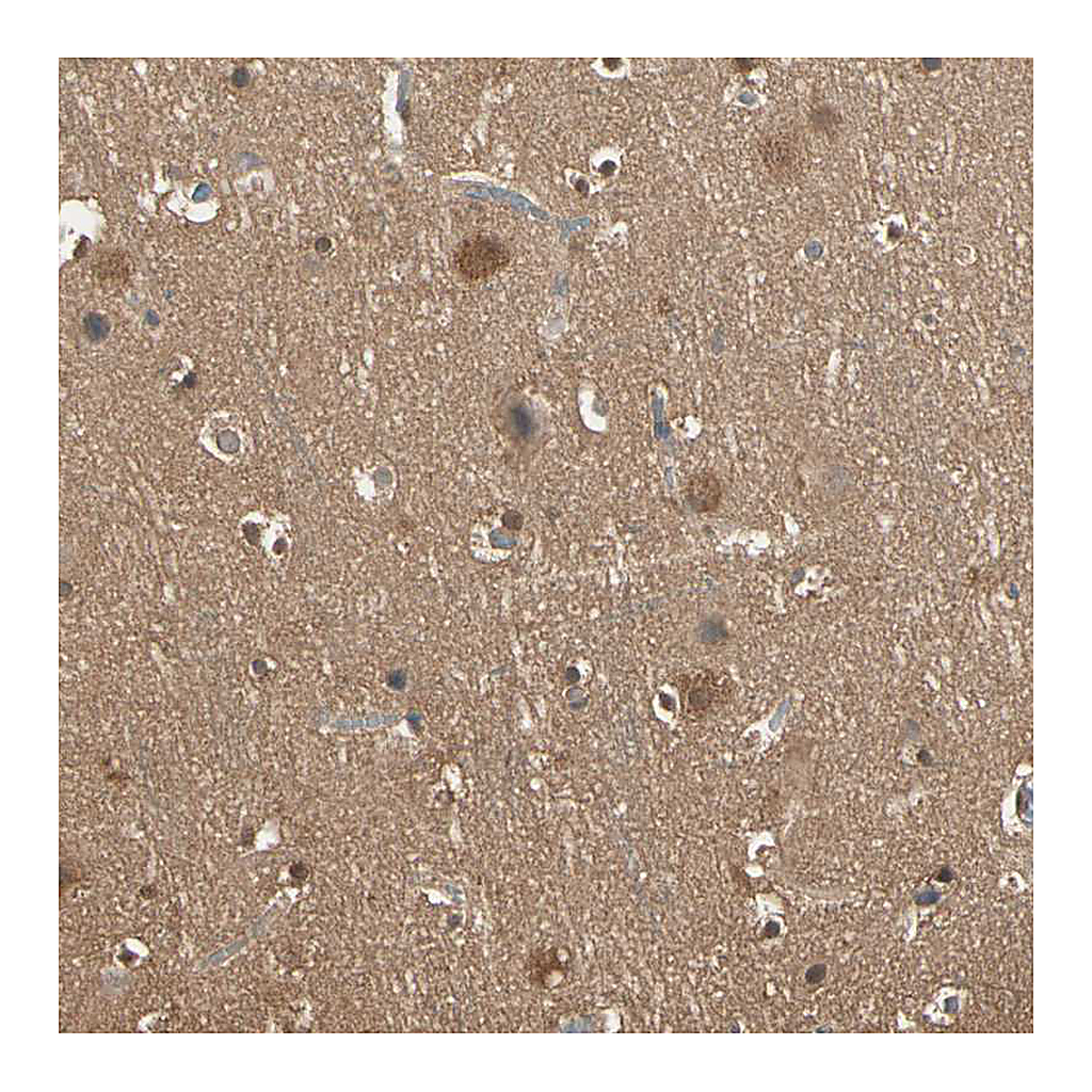 Atlas Antibodies Anti-PNCK Antibody