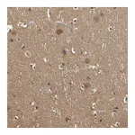 Atlas Antibodies Anti-PNCK Antibody
