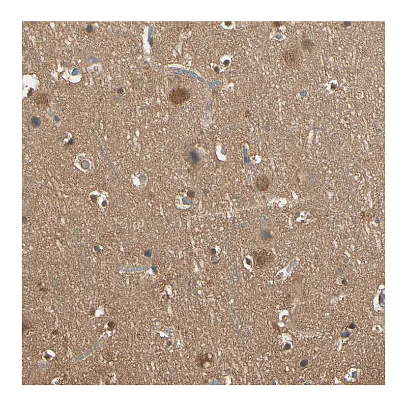 Atlas Antibodies Anti-PNCK Antibody