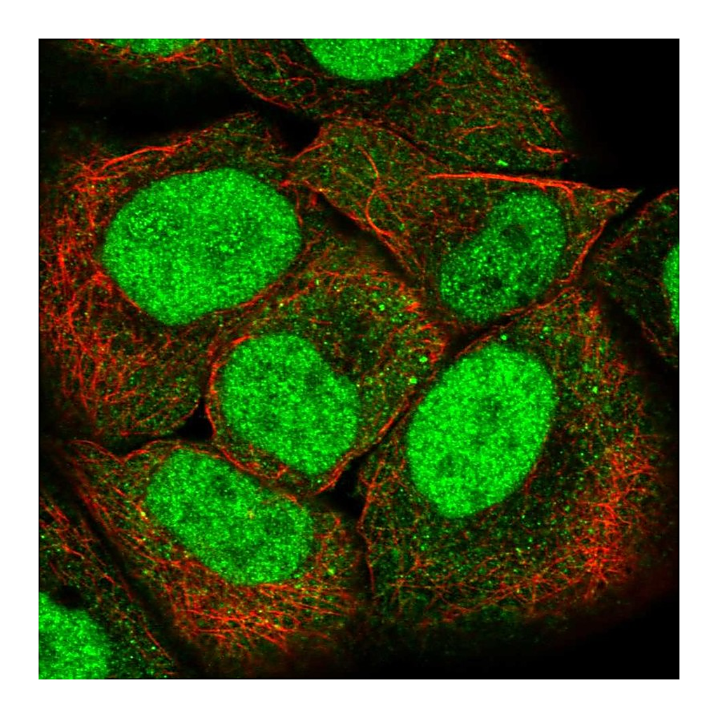 Atlas Antibodies Anti-PMS2 Antibody
