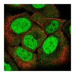 Atlas Antibodies Anti-PMS2 Antibody