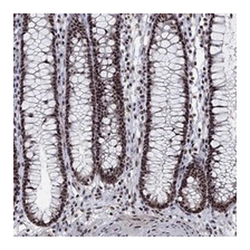 Atlas Antibodies Anti-PNISR Antibody