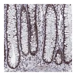 Atlas Antibodies Anti-PNISR Antibody