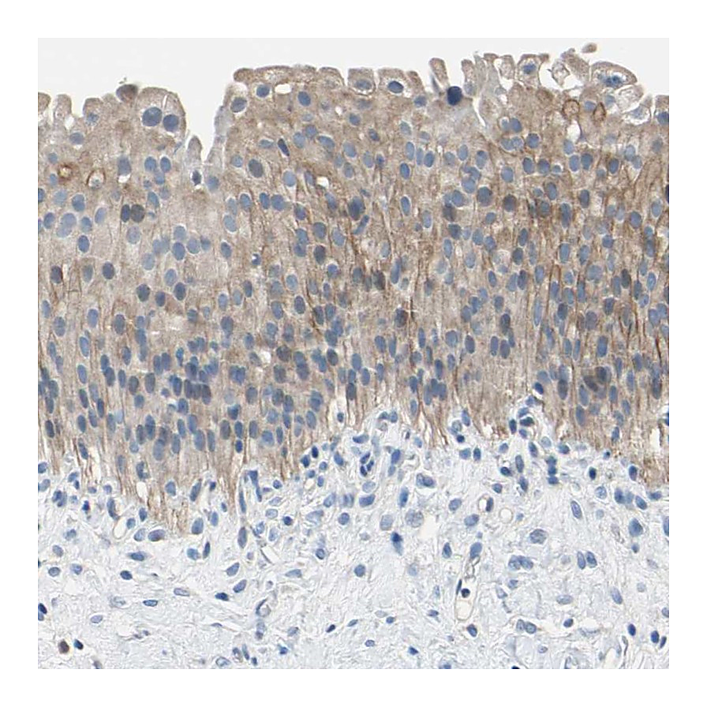 Atlas Antibodies Anti-PNKD Antibody