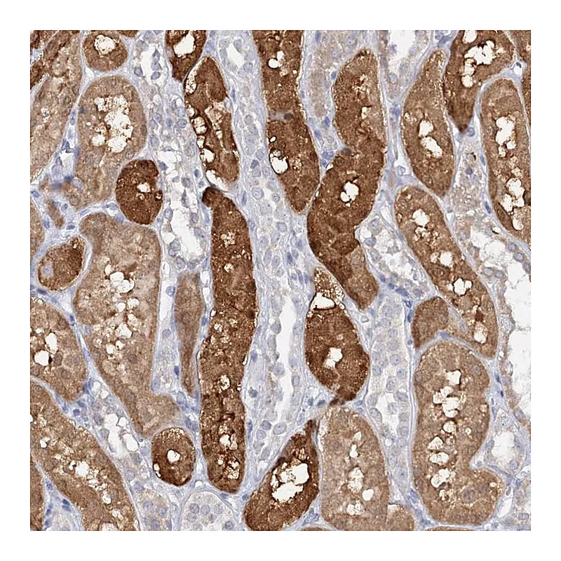 Atlas Antibodies Anti-PNISR Antibody