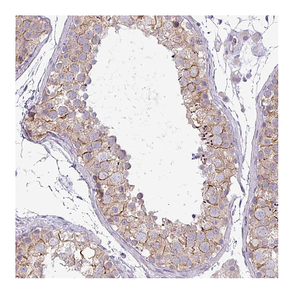Atlas Antibodies Anti-PNLDC1 Antibody