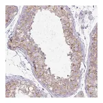 Atlas Antibodies Anti-PNLDC1 Antibody